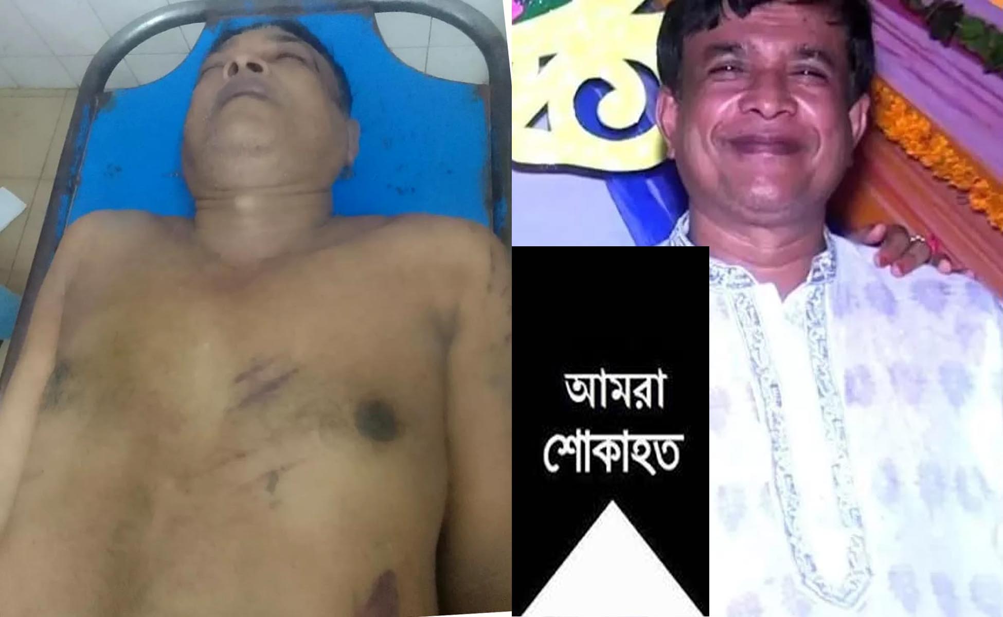 লক্ষ্মীপুরে দুর্বৃত্তের অতর্কিত হামলায় আওয়ামীলীগ নেতার মৃত্যু