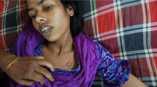 সরিষাবাড়ীতে ছেলেকে টাকা দেওয়ায় স্ত্রীকে বিড়ির আগুনে দগ্ধ করে স্বামীর নির্যাতন