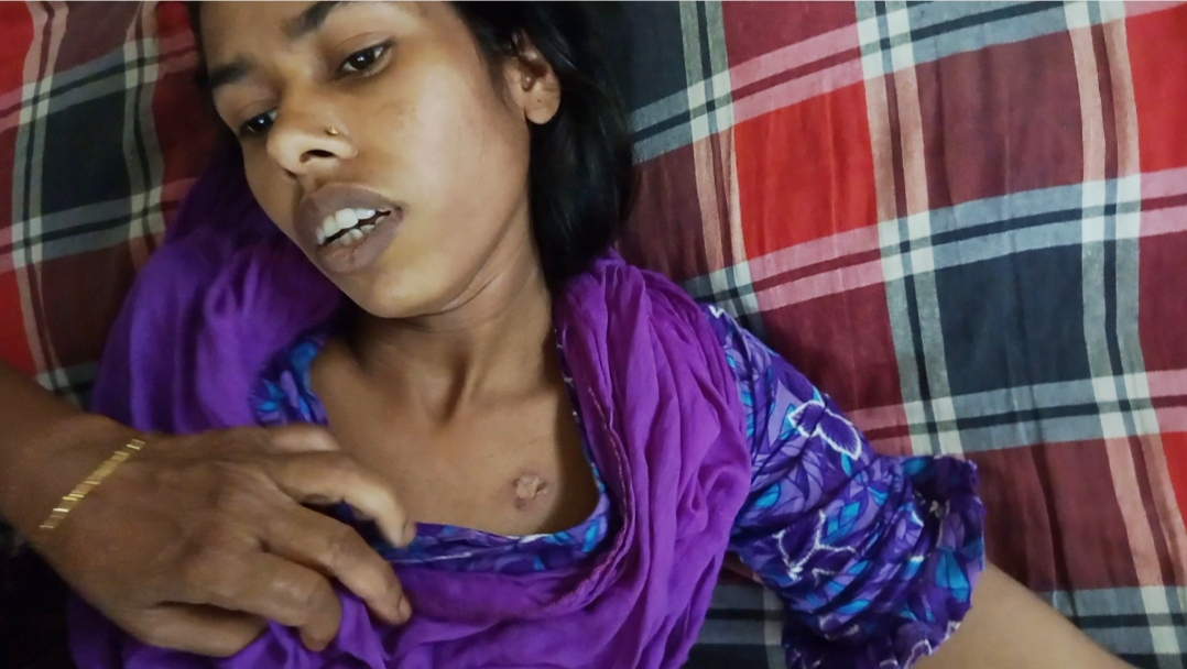 সরিষাবাড়ীতে ছেলেকে টাকা দেওয়ায় স্ত্রীকে বিড়ির আগুনে দগ্ধ করে স্বামীর নির্যাতন