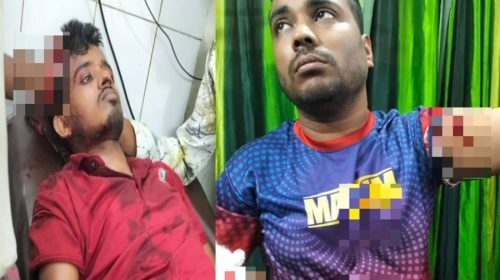 আড়াইহাজারে পূর্ব শত্রুতার জেরে দুজনকে কুপিয়ে জখম