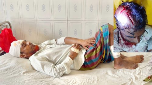 ধনবাড়ীতে পল্লী চিকিৎসককে কুপিয়ে হত্যা চেষ্টা