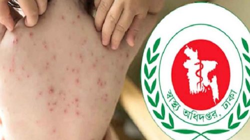 হামের উপসর্গ নিয়ে আরও ১০ শিশুর মৃত্যু
